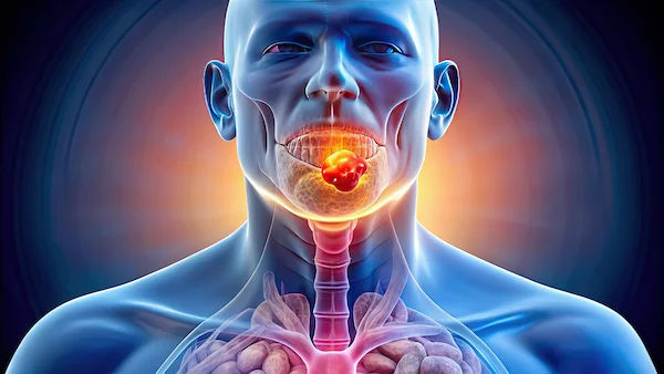 Signs Of Metastatic Squamous Neck Cancer
