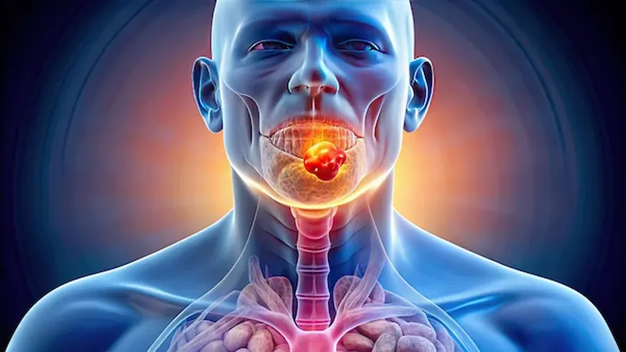 Signs Of Metastatic Squamous Neck Cancer