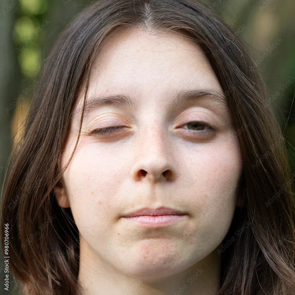 Myasthenia Gravis Overview and Treatment Options