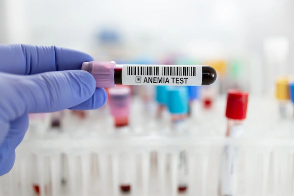 anaemia test