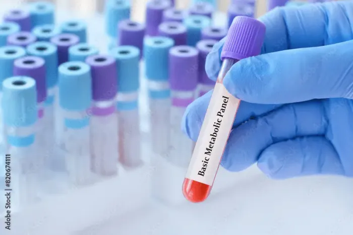 Basic Metabolic Panel Overview and Procedure