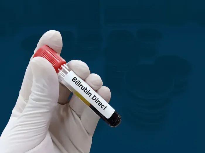 Bilirunbin Test Normal Range And Benefits