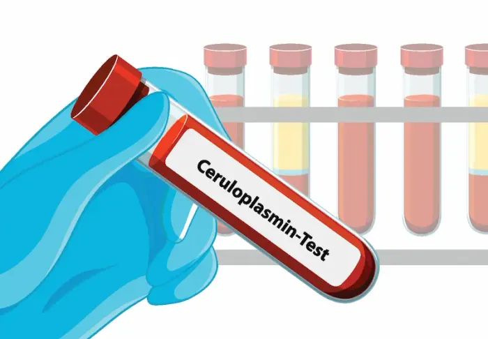 Ceruloplasmin Test Overview and Information