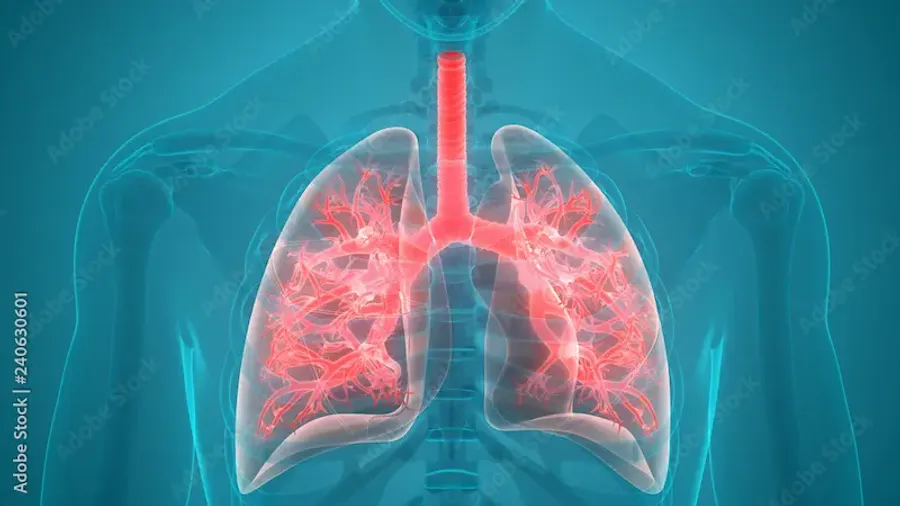 Can You Get Pneumonia from the Cold Weather Understanding the Relationship