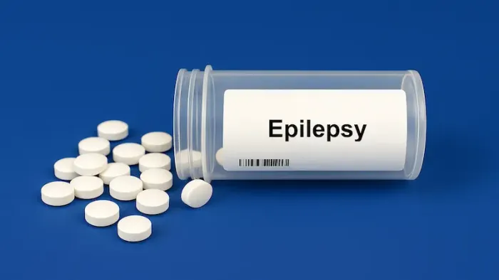 Understanding Epilepsy