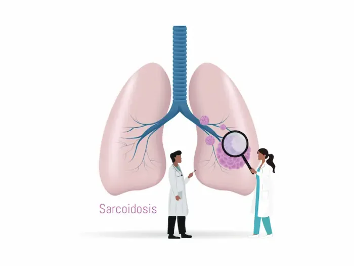 Understanding Sarcoidosis: Causes and Treatment Options