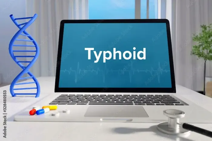 Understanding Typhoid Fever