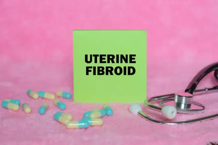 Your Guide to Uterine Fibroid Treatment Options & How to Choose