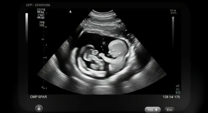 Your Week-by-Week Guide to Amazing Foetal Development