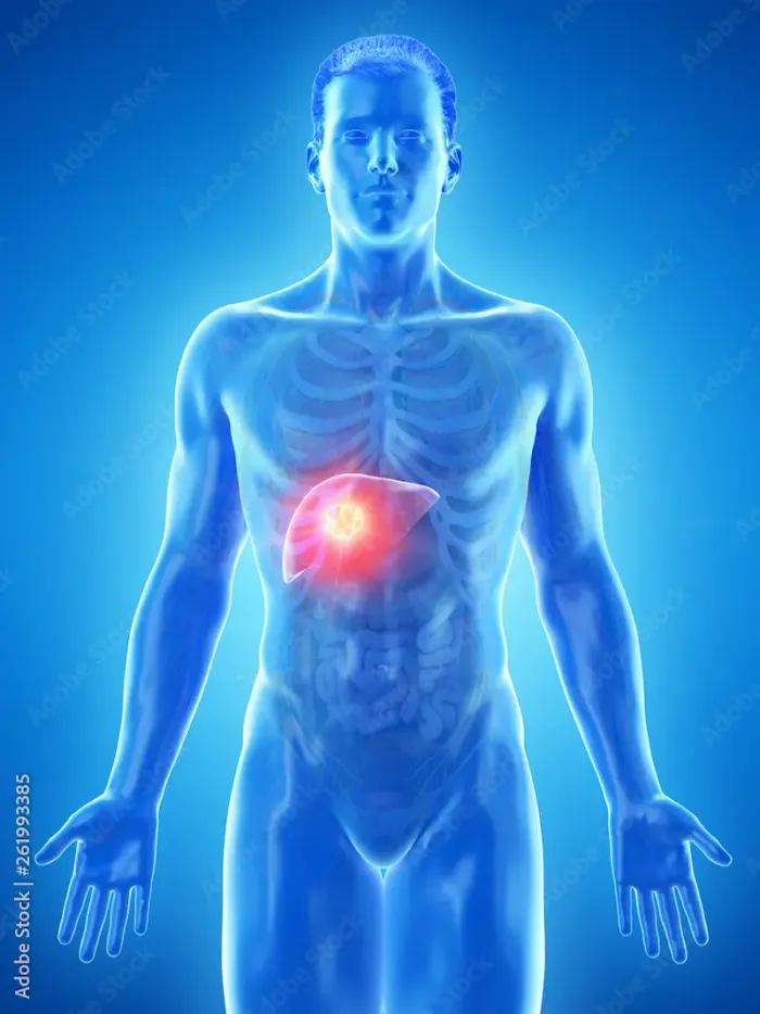 Understanding Your Liver’s Role and How Damage Occurs