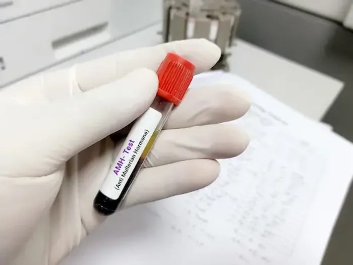 AMH Test: Full Form and Explanation