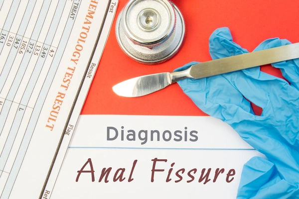 anal fissure