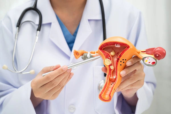 gynaecological oncology