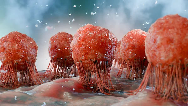 How Does a Tumour Develop? A Step-by-Step Guide to Cancer Growth