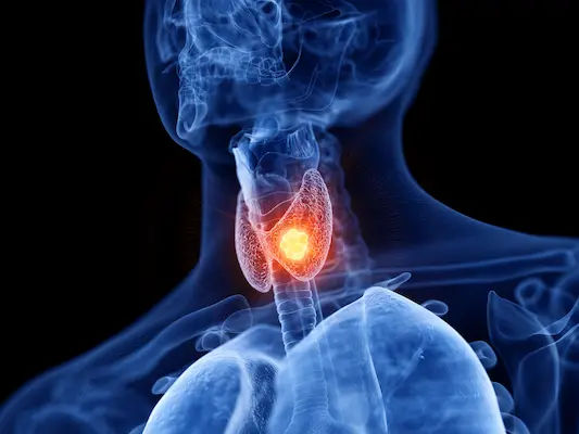 What Leads To Signs Of Thyroid Disease Test And Types