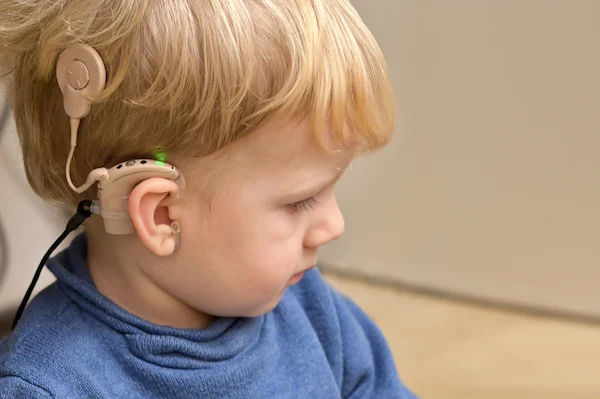 From Silence to Sound: A Guide to the Importance of Cochlear Implants
