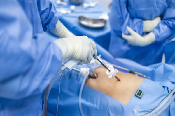 laparoscopic surgery