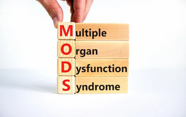 Multiple Organ Dysfunction Syndrome (MODS): A Guide to the Domino Effect