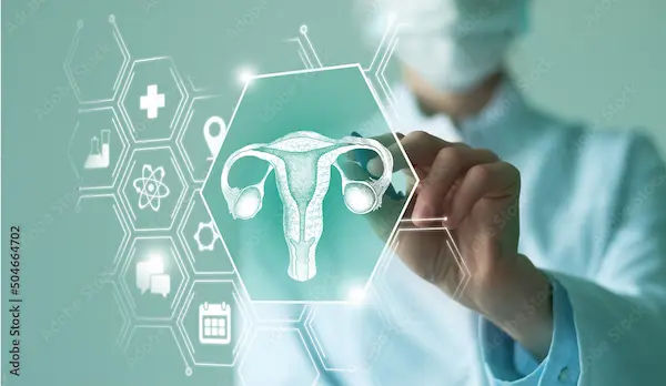 Ovarian Cancer Recurrence After Hysterectomy