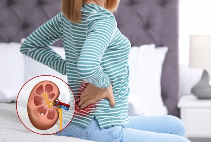 kidney stones pain