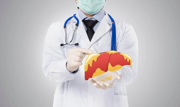 can glutathione cure fatty liver Efficacy of glutathione for the treatment of nonalcoholic fatty liver  disease: an open-label, single-arm, multicenter, pilot study | BMC  Gastroenterology main image 1