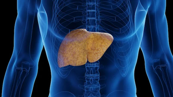 Guide to Stages Alcoholic Liver Disease And How