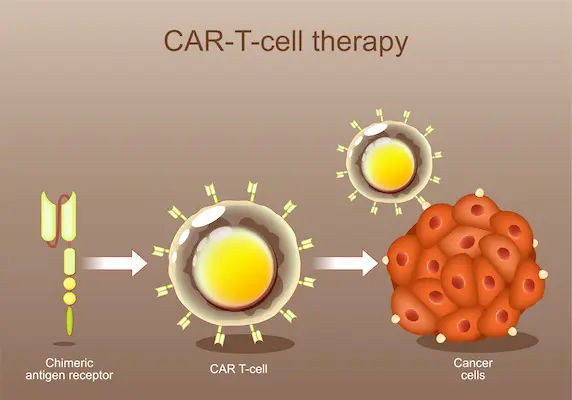 Cancer Treatment With Car T Cell Therapy