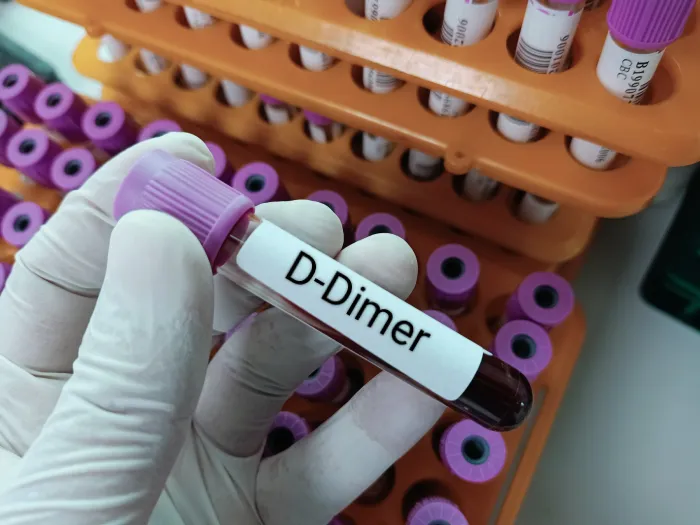D-Dimer Test: Full Form and Overview