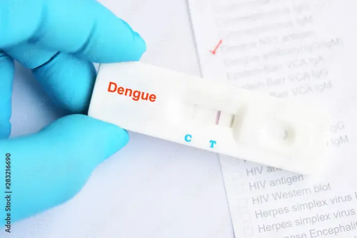 Dengue Diagnosis Test Overview