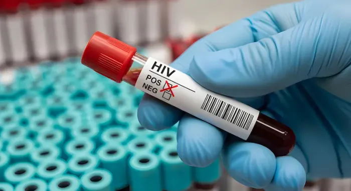 HIV Myths and Misconceptions Explained