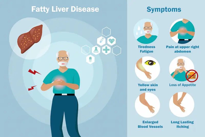 Understanding Grade 2 Fatty Liver Disease