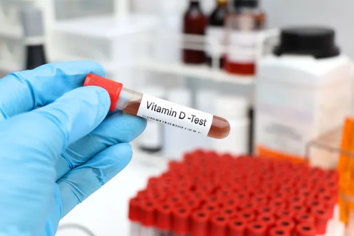Vitamin D Test: Why, When, and How to Check Your Levels