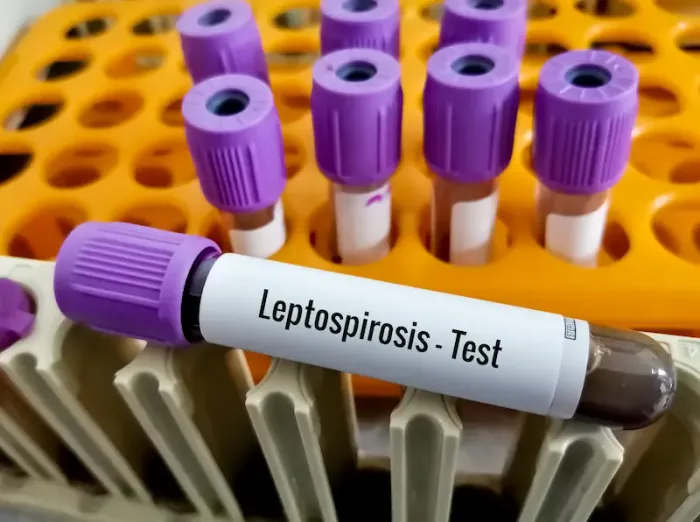 What Leads To Signs Of Leptospirosis