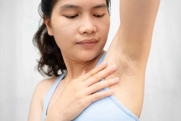 Lighten Dark Underarms