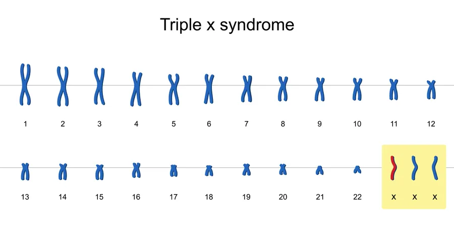 Triple X Syndrome