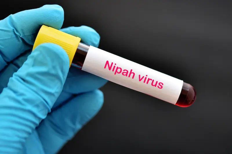 Nipah Virus Overview and Prevention Measures