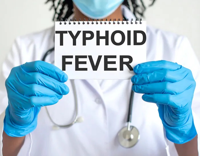 Typhoid Diet Guidelines for Recovery