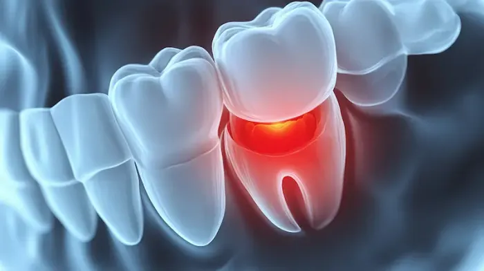 Understanding Abscesses and Cysts
