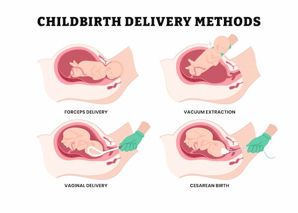 Types of Delivery Methods