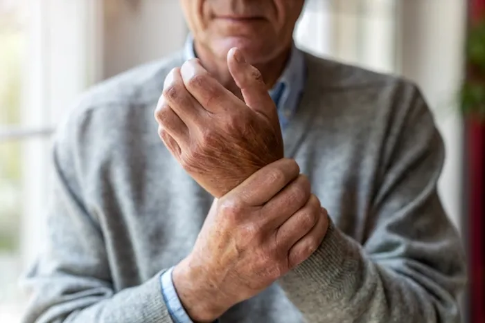 rheumatoid arthritis