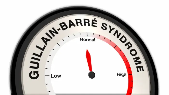 Signs, Treatment and Management Of Guillain-Barré Syndrome
