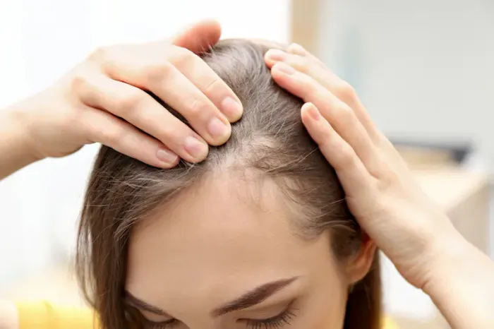 Home Remedies for Hair Thinning Naturally