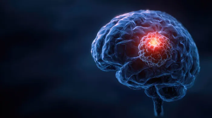 Guide to Types Of Brain Tumours