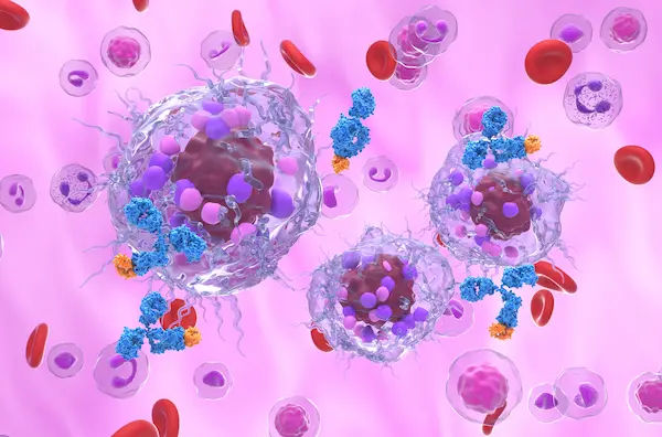 Understanding Neuroendocrine Tumors: Types, Causes, Symptoms, and Treatment