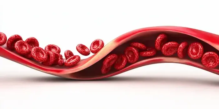 Takayasu's Arteritis
