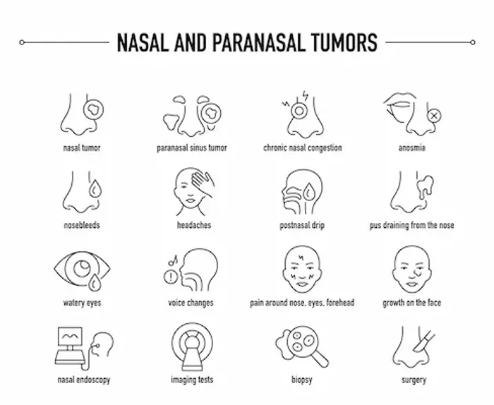 All About Nasal and Paranasal Tumours: A Comprehensive Guide