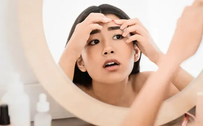 How To Get Rid of Acne: A Comprehensive Guide