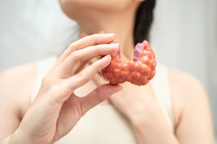hyperthyroidism