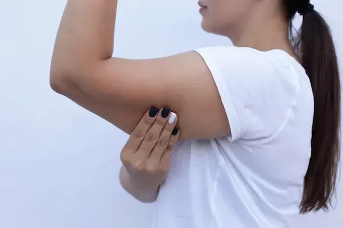 How To Reduce Biceps Fat?