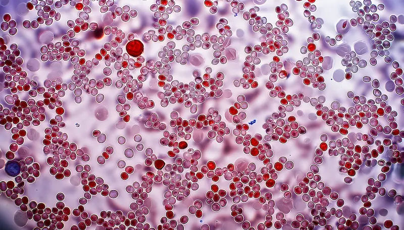 How To Reduce Tlc In Blood?